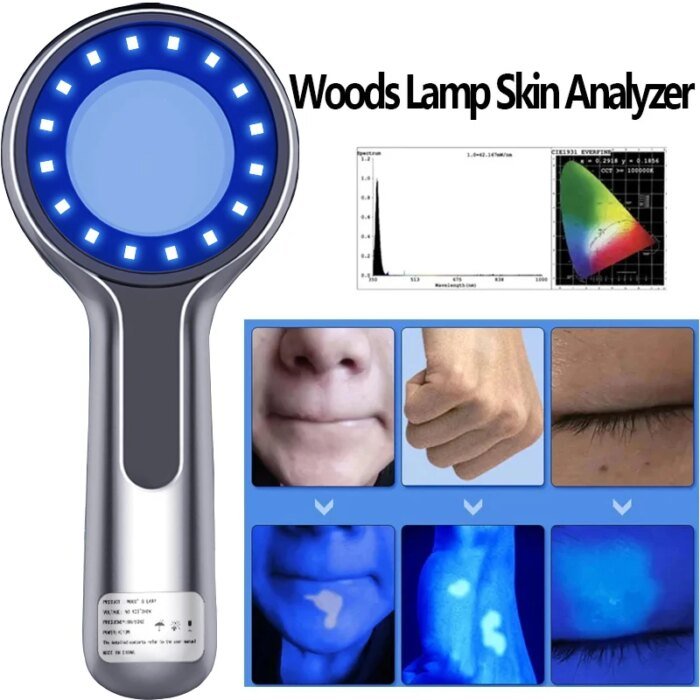 Wood’s Lamp hudanalysator med UV-förstoringsglas för ansiktstestning - Bild 4
