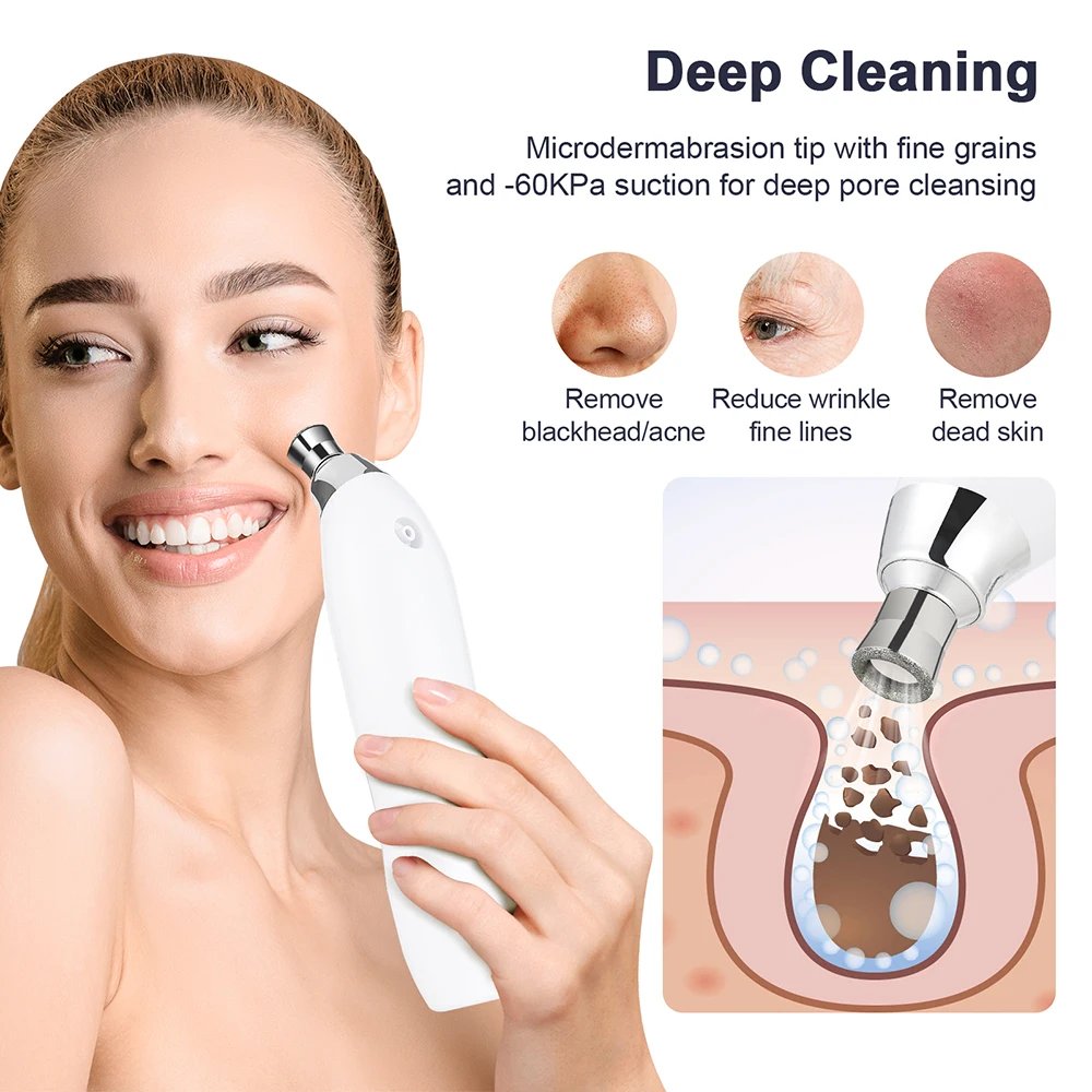 Bärbar Diamantslipning och Microdermabrasion för Djuprengöring Bärbar Diamantslipning och Microdermabrasion för Djuprengöring